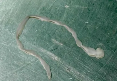 *A Plague Tale* Comes to Life? An 8-Centimeter Worm in the Brain Is Absolutely Terrifying
